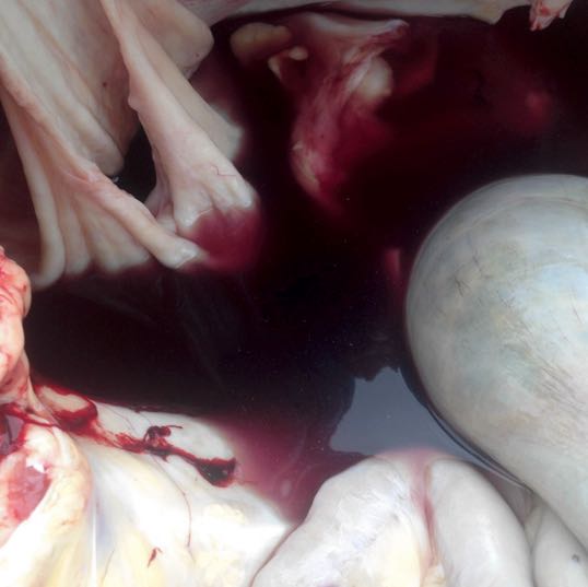 Image of bladder on post-mortem showing haematuria