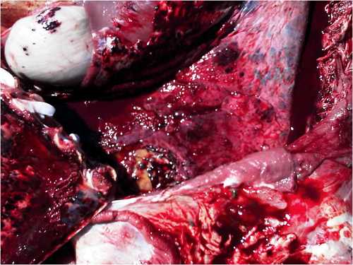Image of clotted blood in thorax