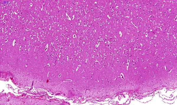 phalaris sudden death lambs affected lamb histopathology cerebrocortical vacuolation