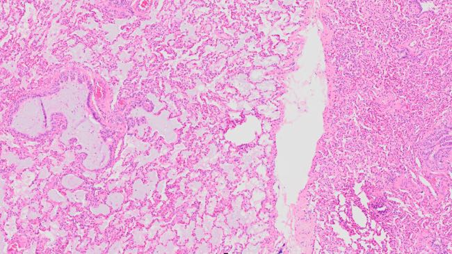 Photomicrograph of histological section of bovine lung showing mucus-filled alveoli