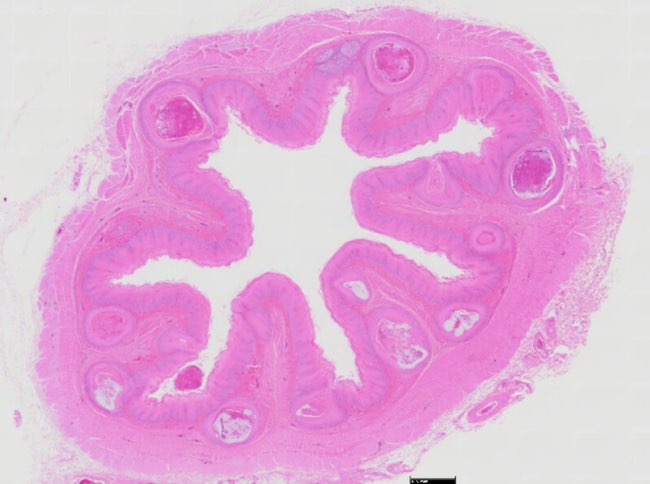 Photomicrograph of chicken oesophagus with gland metaplasia