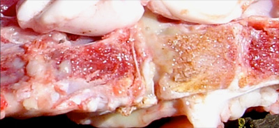 Image of sectioned sheep vertebral abscess <em>post-mortem</em>