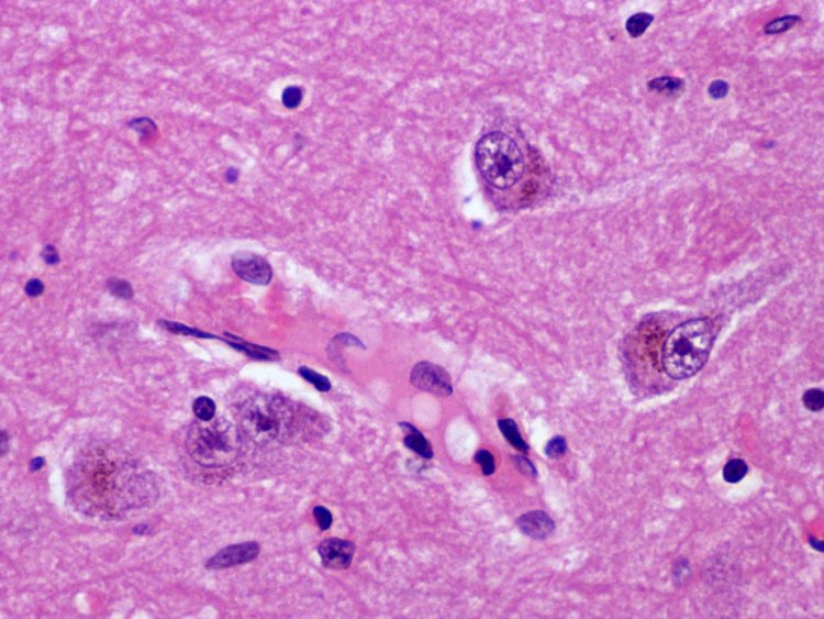 Photomicrograph of ovine brain showing dark brownish intracytoplastic granules in neurons